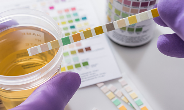 UTI test