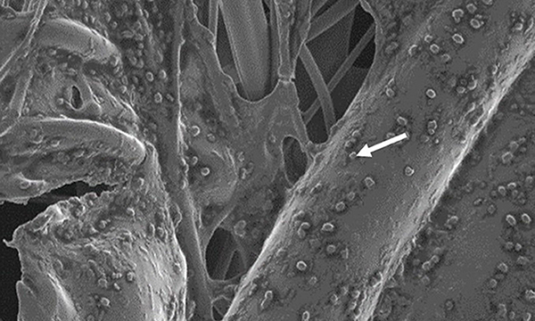 C. difficile