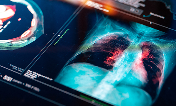 A screen showing coloured images from a lung scan