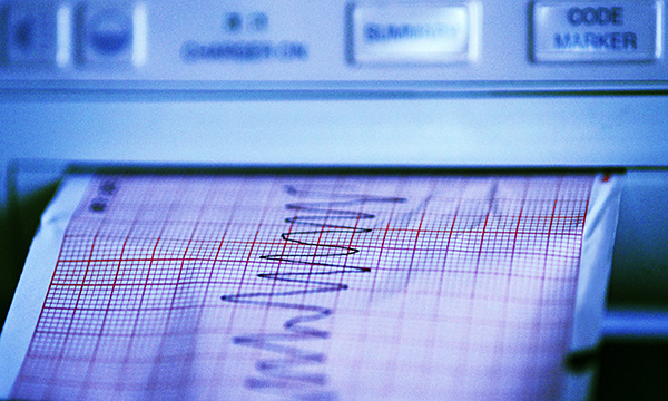 ECG read-out