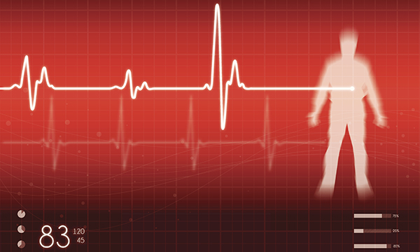 Cardiac arrest