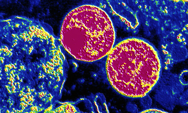 Chlamydia