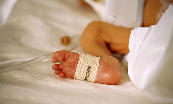 Low birth weight