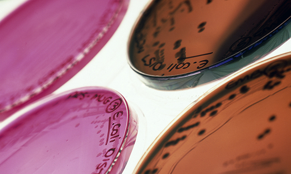Petri dishes