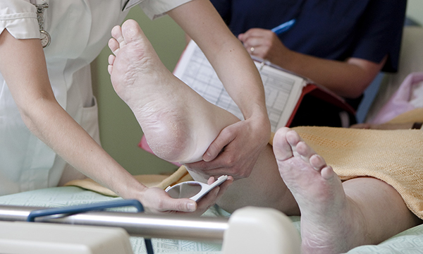 Pressure ulcer prevention