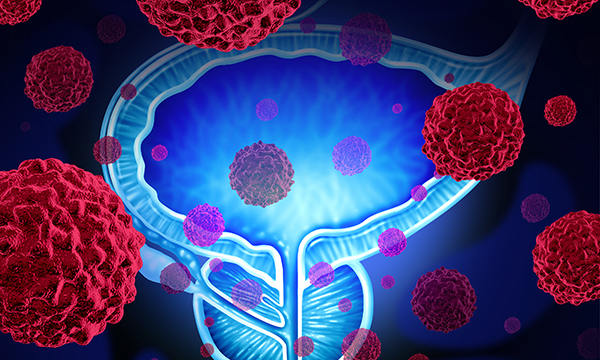 prostate