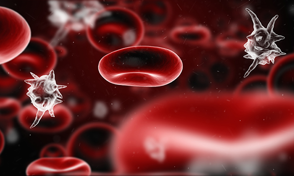 Sepsis