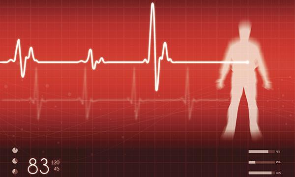 Cardiac arrest
