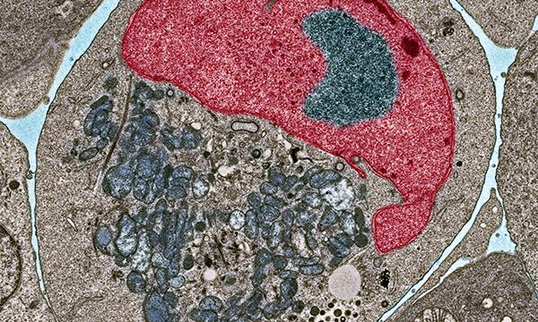 Myeloma cell