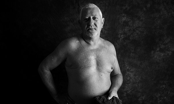 Picture shows a man naked from the waist up, with a scar where one breast has been removed. People with cancer are allowing pictures of themselves displaying the scars from their treatment to be used in the fundraising Defiance project.
