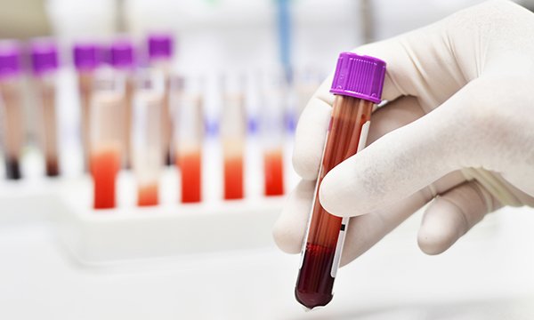 Non-urgent primary care and community blood testing halted until 17 September