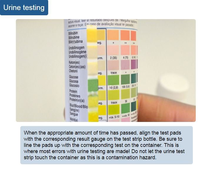 Urine Monitoring Chart