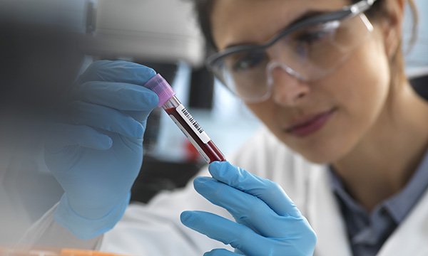 Analysis of blood sample