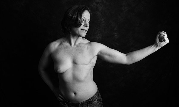 Picture shows a woman naked from the waist up, with a scar where one breast has been removed. People with cancer are allowing pictures of themselves displaying the scars from their treatment to be used in the fundraising Defiance project.