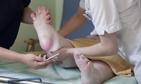 Picture shows two medics examining the skin on a patient’s feet. New international guidance on pressure ulcers includes protecting the skin, managing pain and choosing support surfaces.
