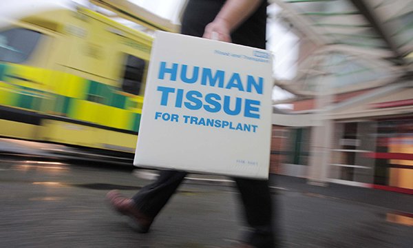 Transplant box