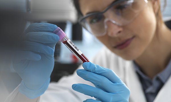 lab scientist handles blood sample