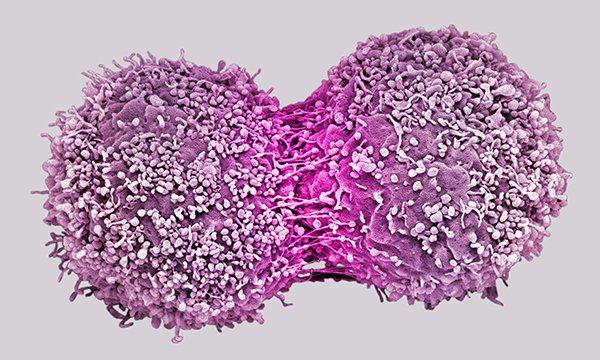 Breast_cancer_cells-SPL.jpg