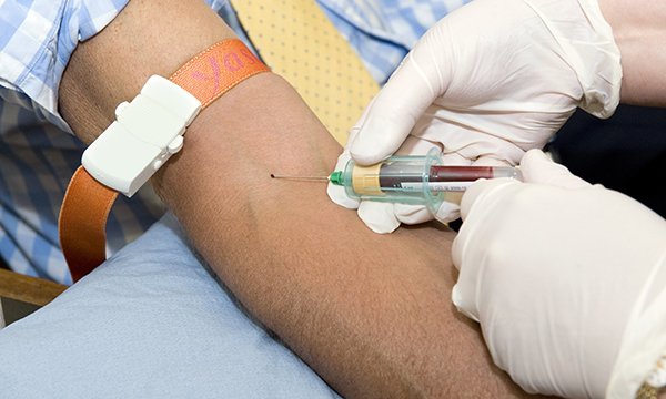 needle insertion in arm