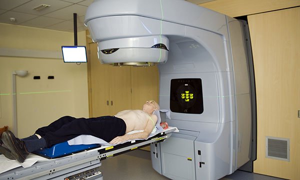 Lung cancer radiotherapy