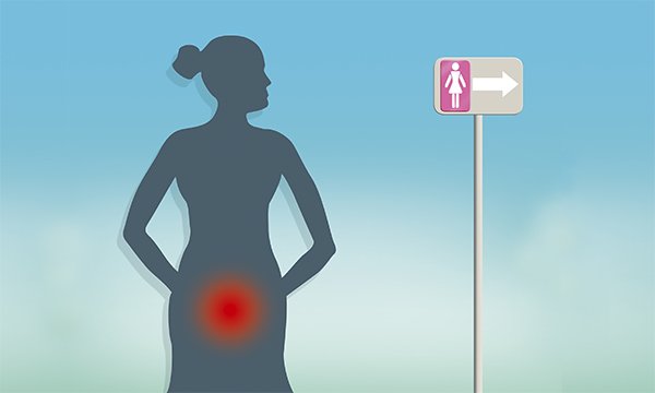 woman with overactive bladder