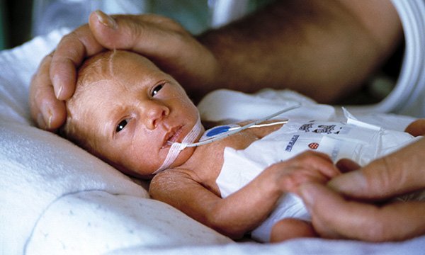 Four steps improve survival rate for premature babies