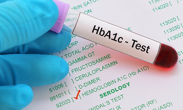HbA1c blood test