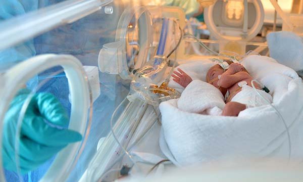 Picture of a newborn in a neonatal care unit