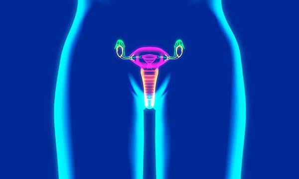 Call to lower threshold for pre-emptive ovarian cancer surgery