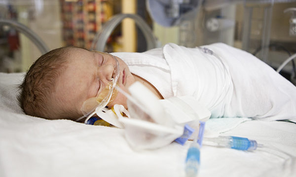 Neonatal intensive care