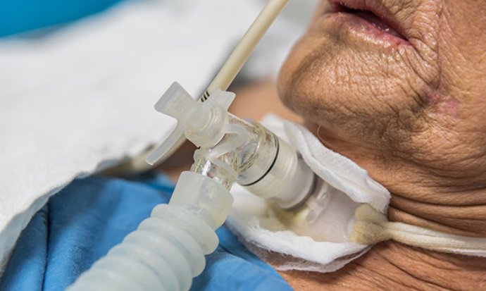 Tracheostomy care: the role of the nurse before, during and after insertion