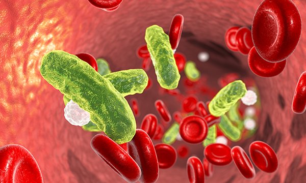 illustration shows bloodstream where sepsis is occurring 
