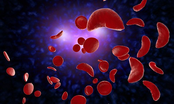 Factors associated with health-related quality of life in children with sickle cell disease