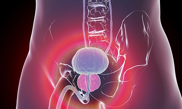 Assessment and management of lower urinary tract symptoms in men