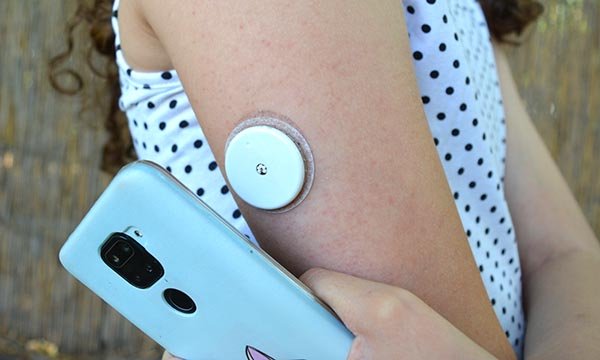 Close up of a young woman’s arm with a continuous glucose monitoring device on it and recording the reading on a mobile phone
