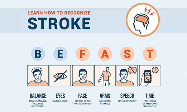 A poster showing how to recognise a potential posterior stroke by using the acronym BEFAST