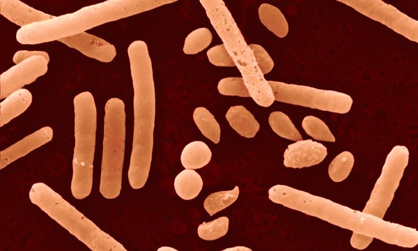 Clostridium difficile bacteria and spores