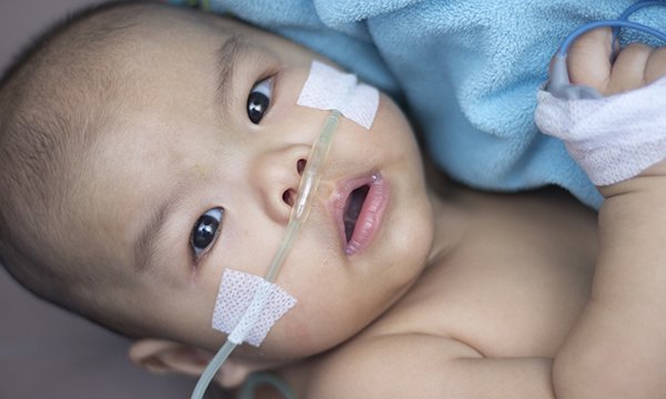 Clinical assessment and management of children with bronchiolitis