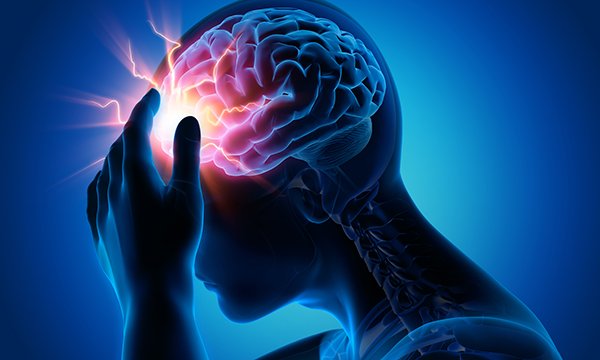 Recognising and managing migraine